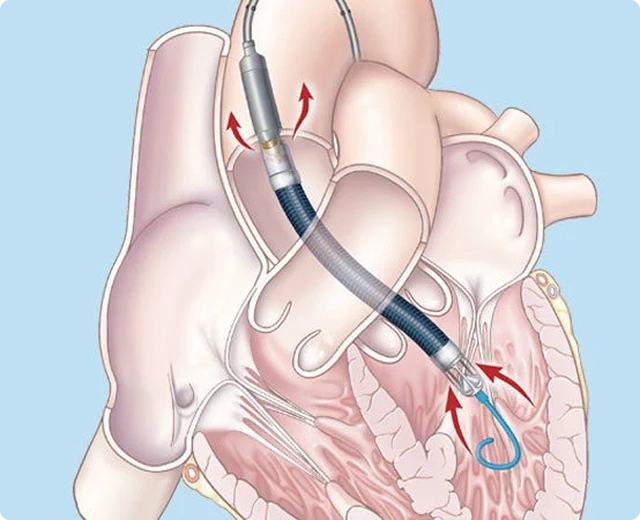 treatment img