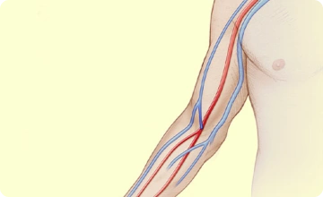 treatment img